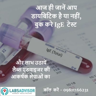 know the cost of IgE test in hindi