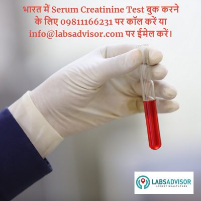 सीरम क्रिएटिनिन टेस्ट क्या है? Serum Creatinine Test ki kimat kya hai?